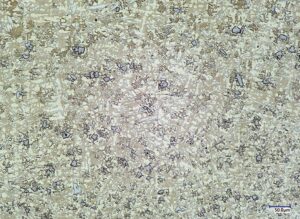 Colmonoy® 56 SPL PTA